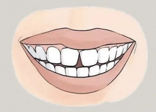 <a href=http://www.hneaie.cn/news_article?news_id=116>一次性口腔探針</a>